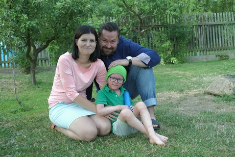 Obrázek: ichtyoza-small