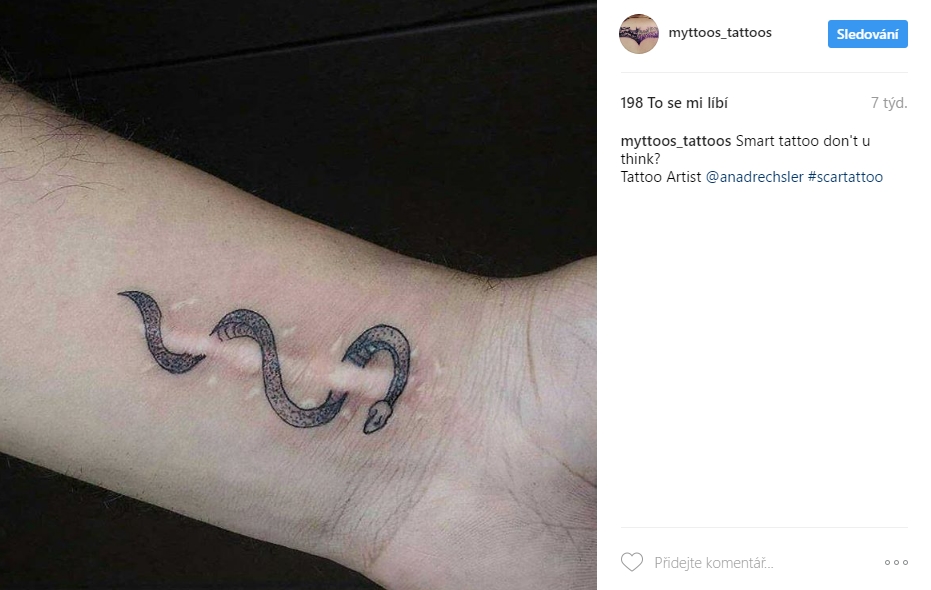 scar tattoo 15