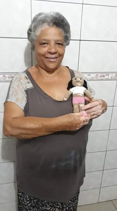 vitiligo dedecek 6