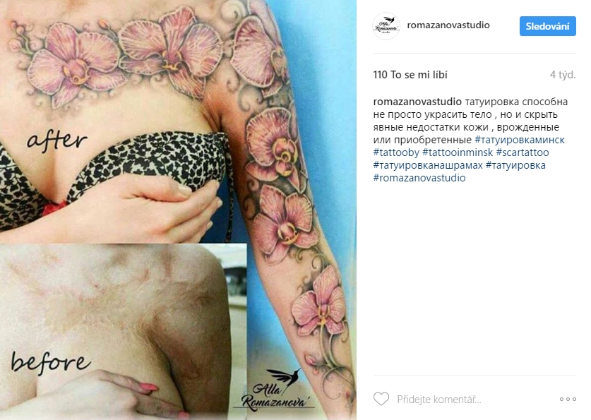 scar tattoo 1