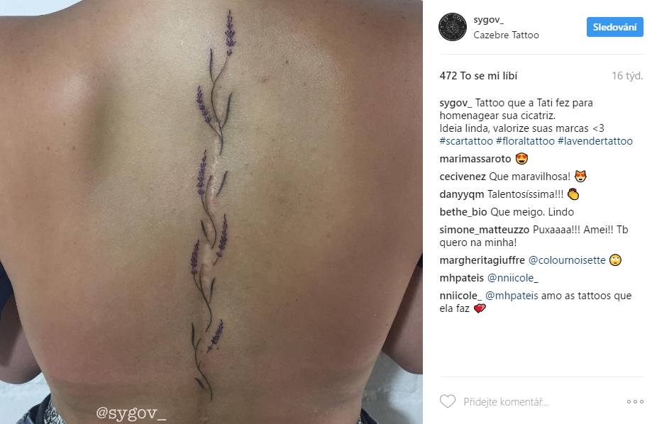 scar tattoo 11