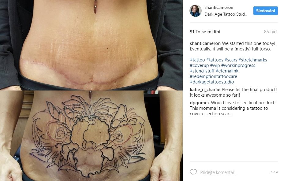 scar tattoo 13