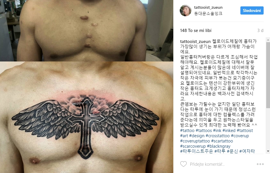 scar tattoo 17