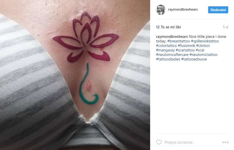 scar tattoo 20