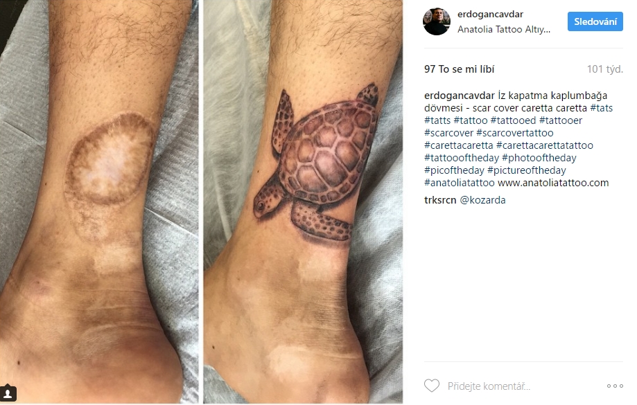 scar tattoo 29