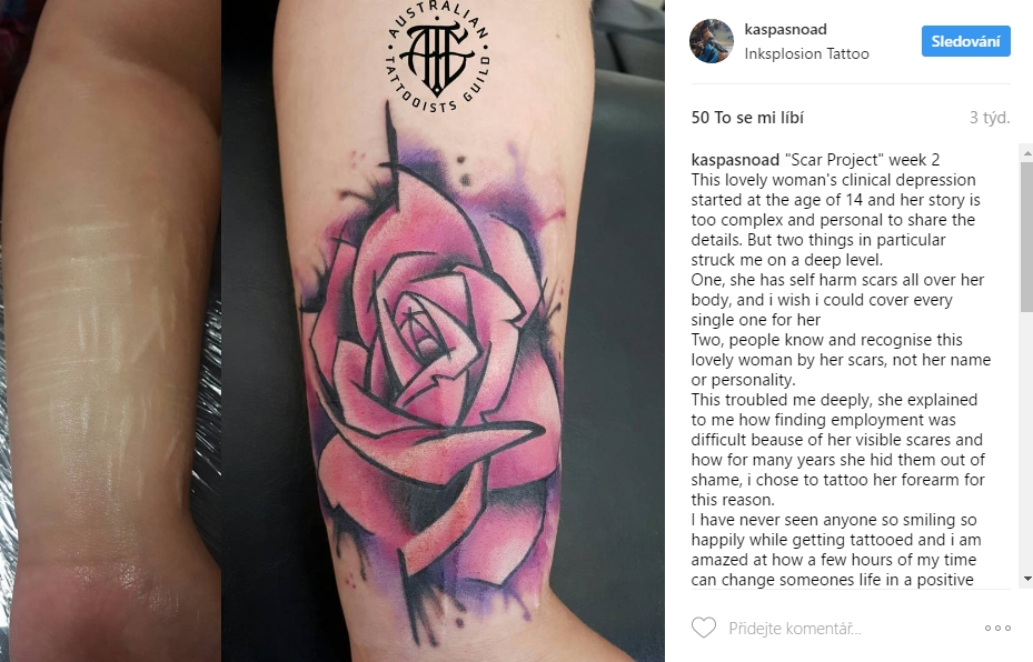 scar tattoo 23