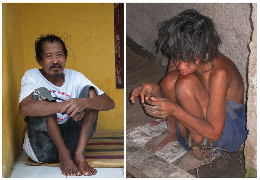 psychiatr bali 9